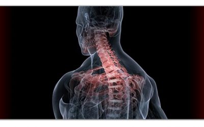 היצרות בתעלת עמוד השדרה (spinal stenosis)   